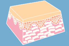 Skin Cross Section after laser skin treatments
