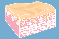 Skin Cross Section before laser skin treatments