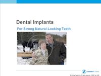 View Dental Implant PDF Presentation